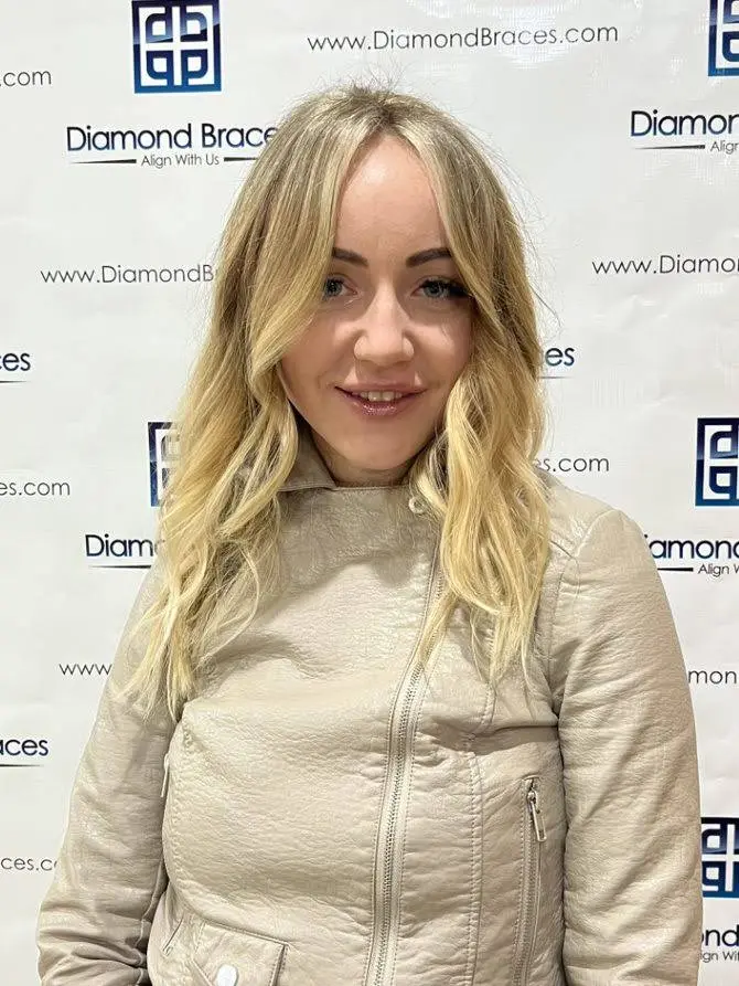 Diamond Braces