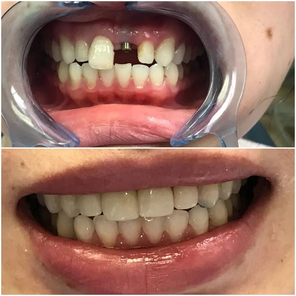Jersey City Dentistry