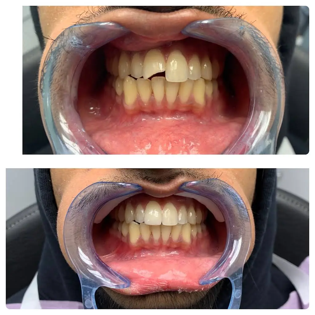 Jersey City Dentistry
