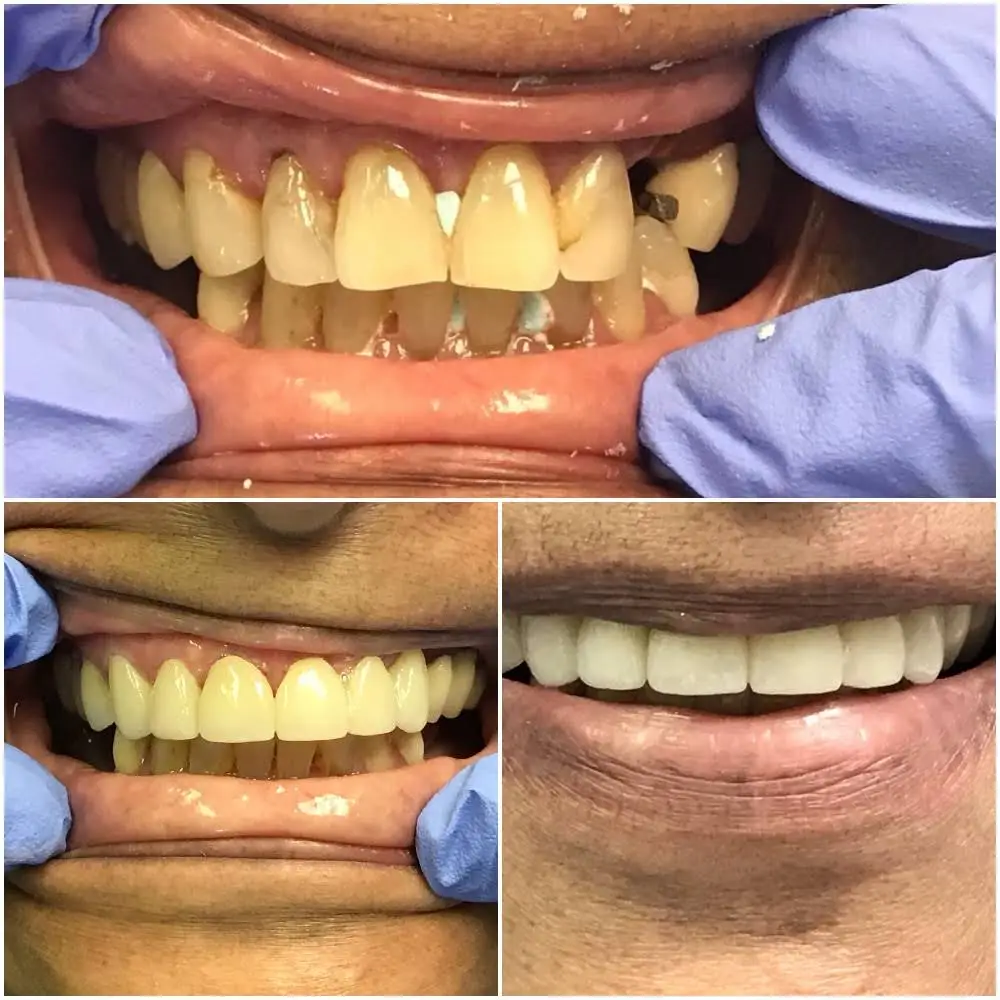 Jersey City Dentistry