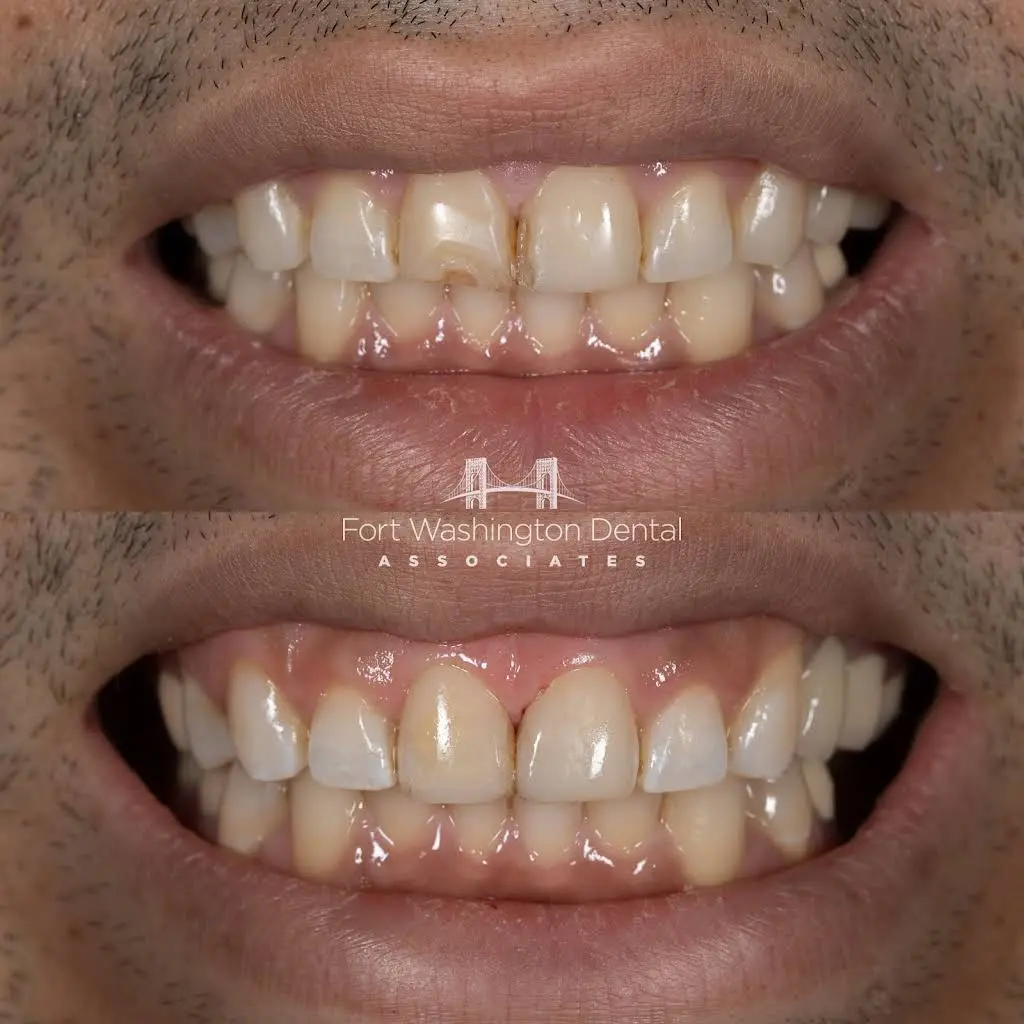Fort Washington Dental Associates