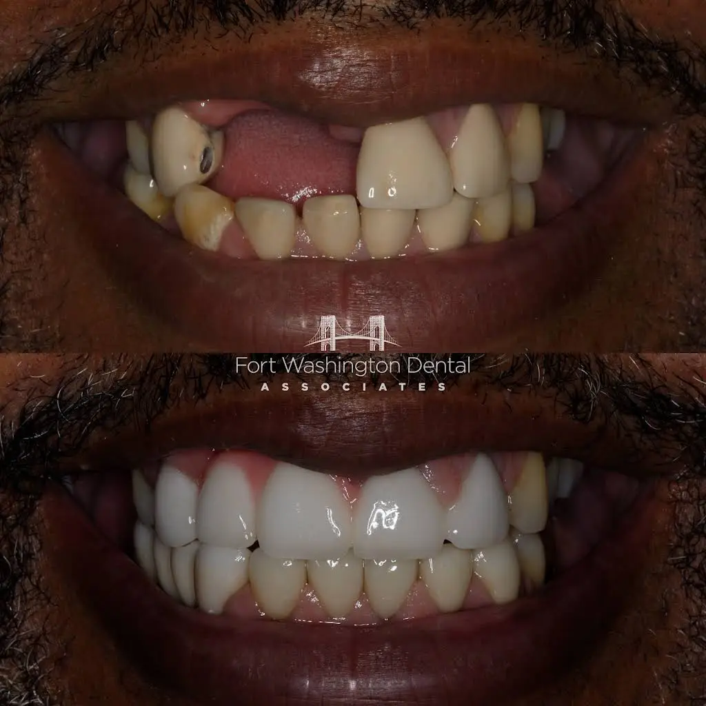 Fort Washington Dental Associates