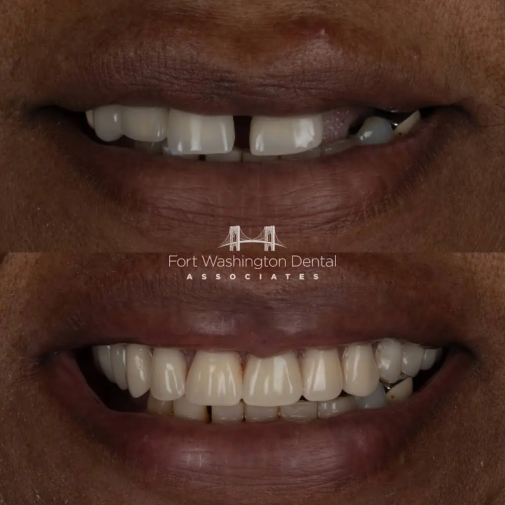 Fort Washington Dental Associates