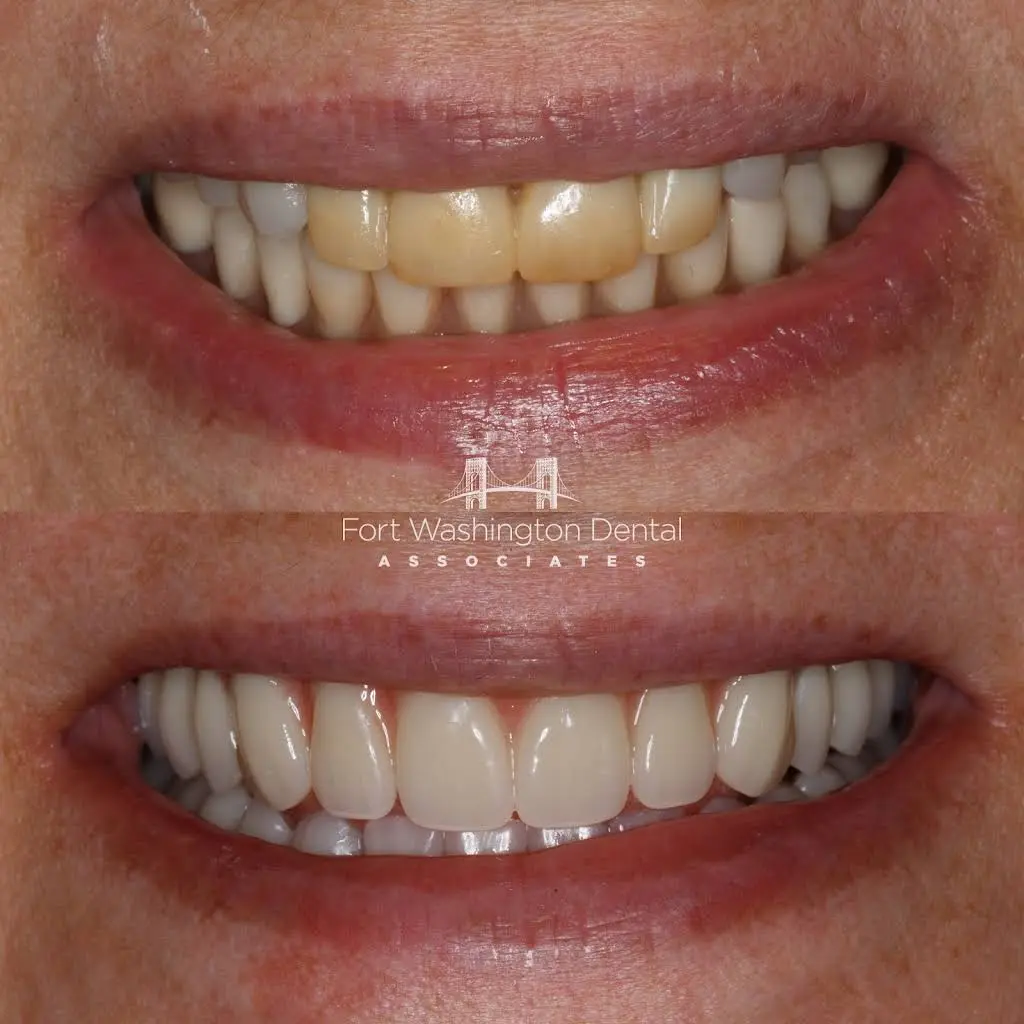 Fort Washington Dental Associates