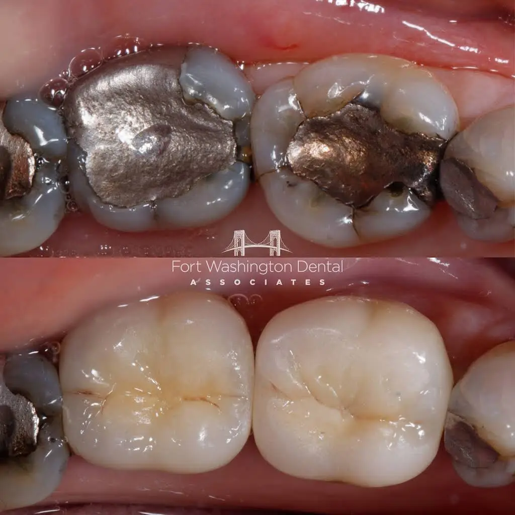 Fort Washington Dental Associates