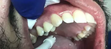 Galan Dental PC