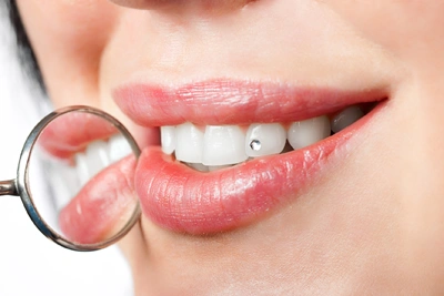 Macabi Dental Associates: Dr. Iris Zuckerman, DDS