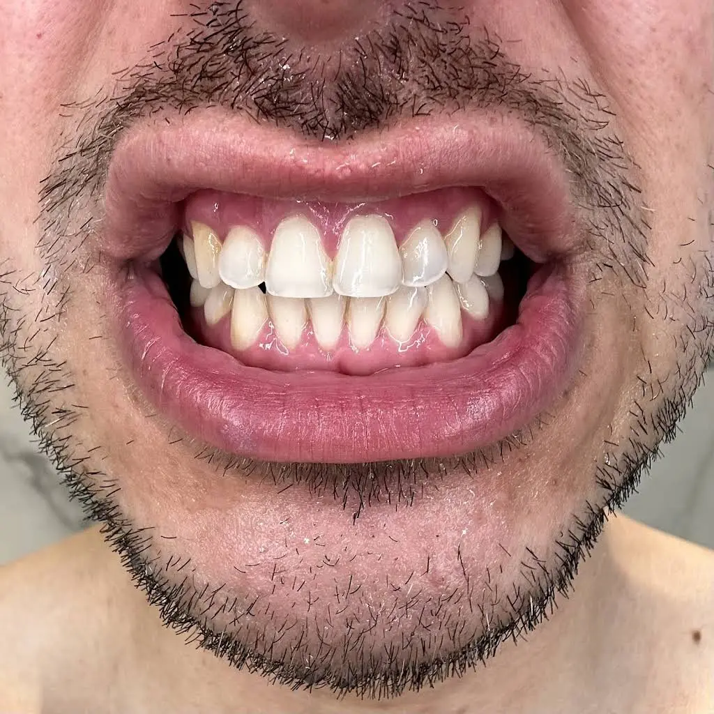 Dental Design Smile NJ