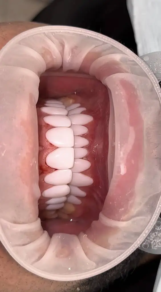 Dental Design Smile NJ
