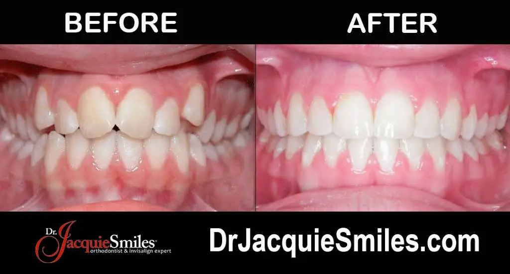 Dr. Jacquie Smiles