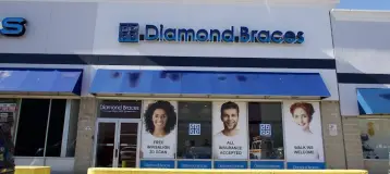 Diamond Braces