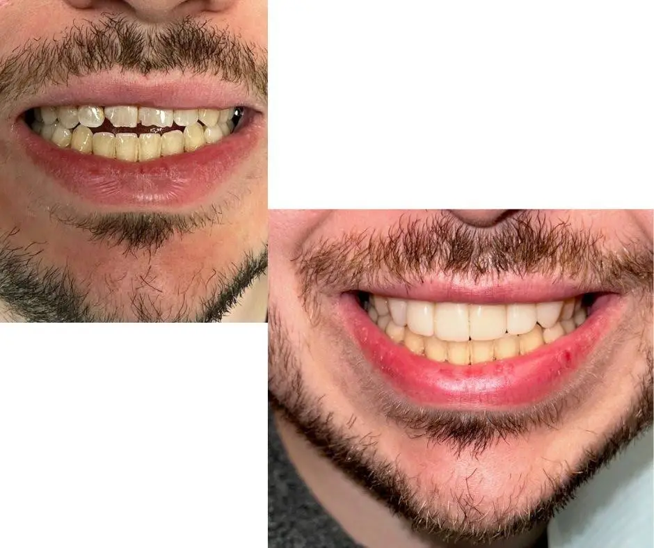 Hanna Dental Group