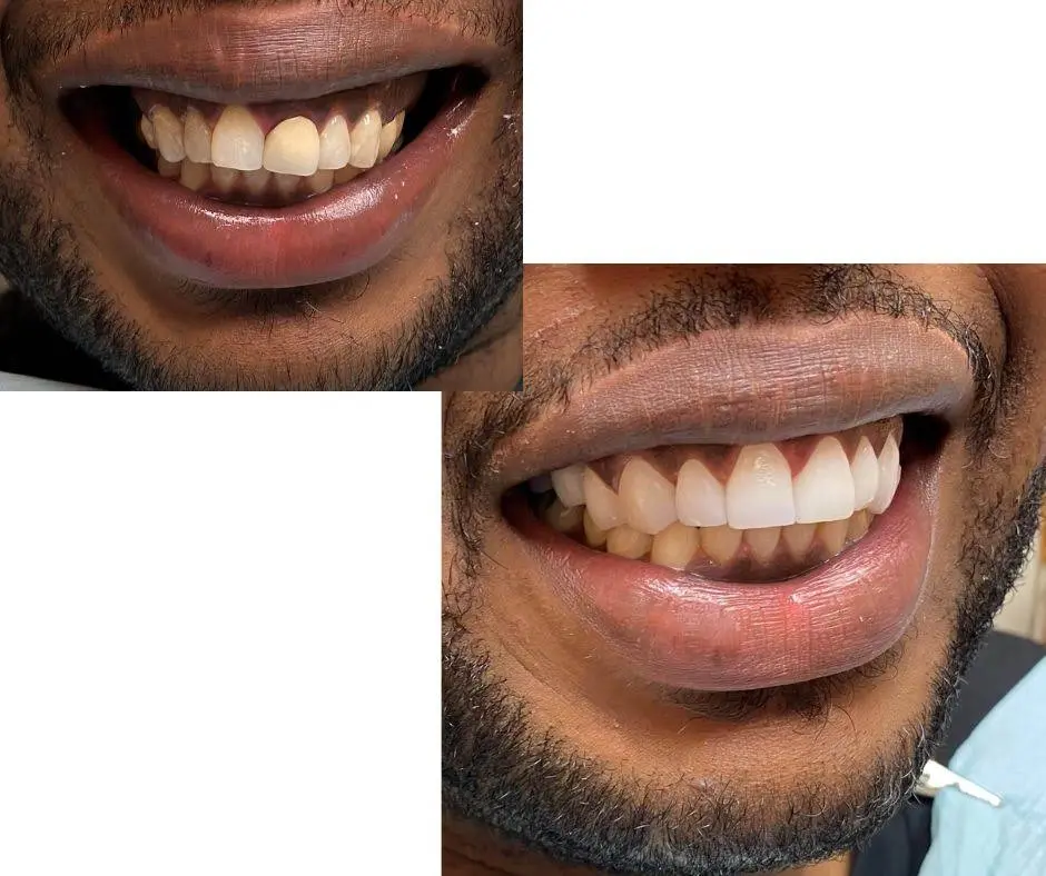 Hanna Dental Group