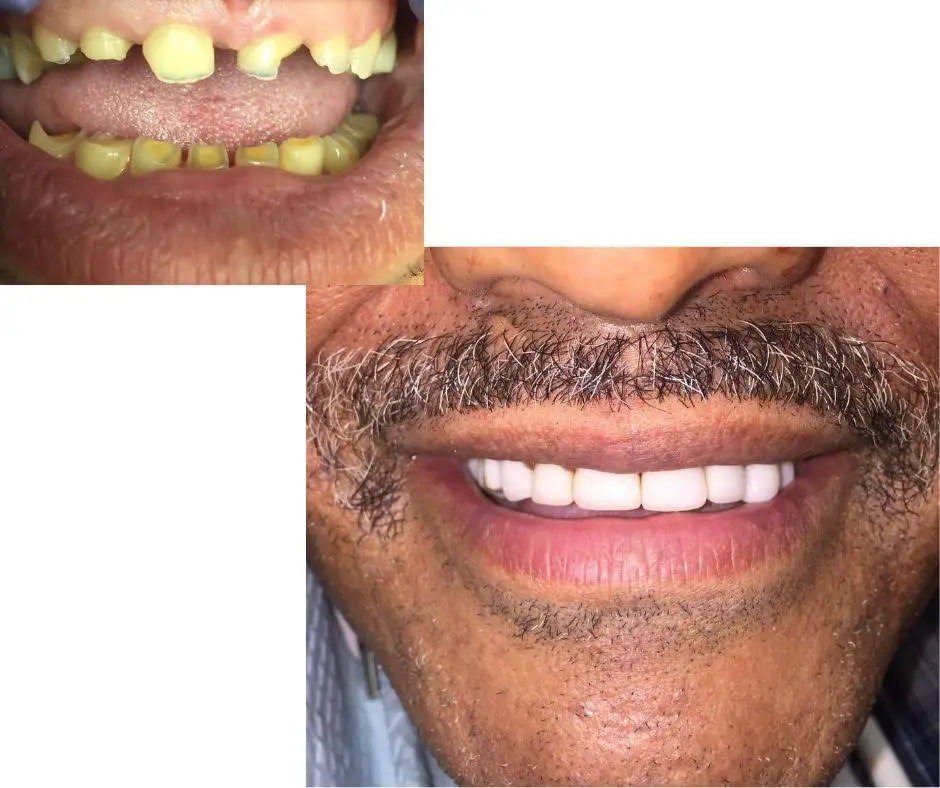 Hanna Dental Group