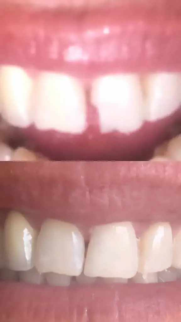 E Z Dental Associates