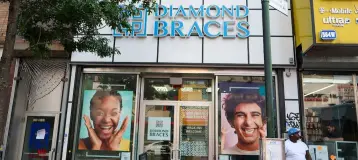 Diamond Braces