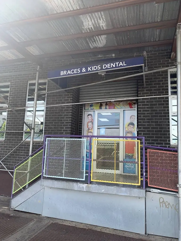 Diamond Braces