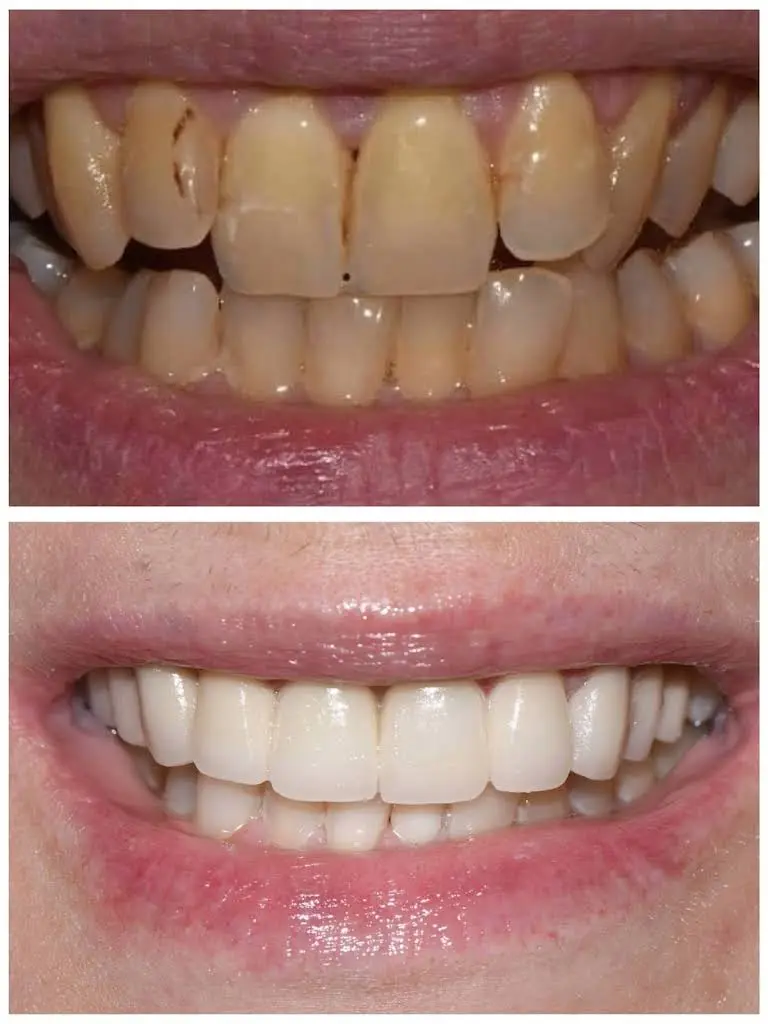 Roslyn Family Dental
