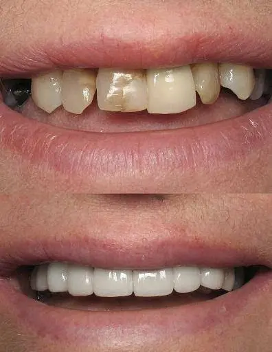 Philip M. Tornatore, DDS
