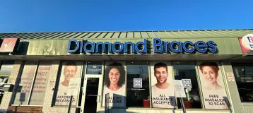 Diamond Braces