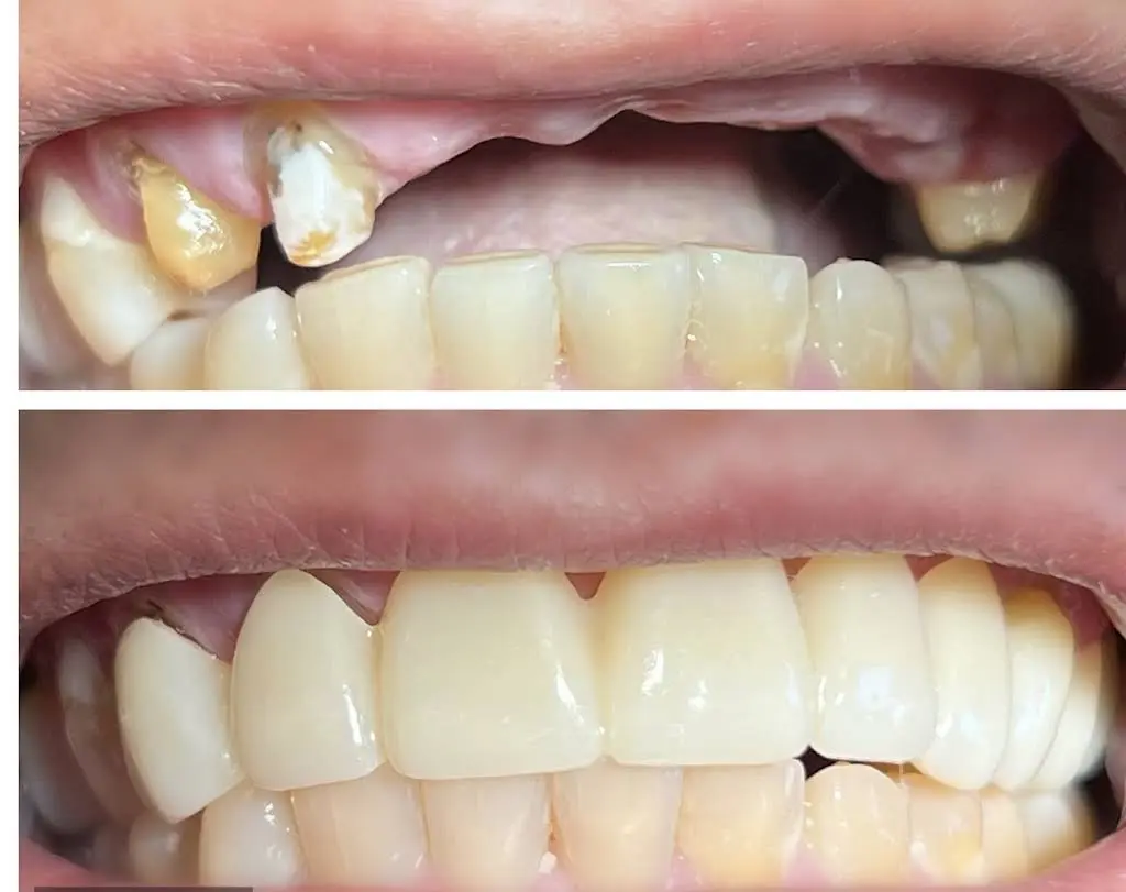 Complete Dental Care of Long Island