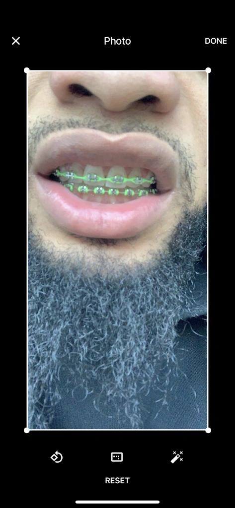 Perfect Smile Doc