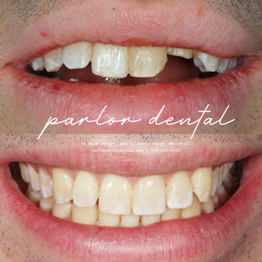 Parlor Dental