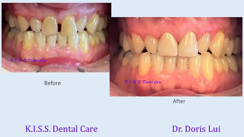 K.I.S.S. Dental Care