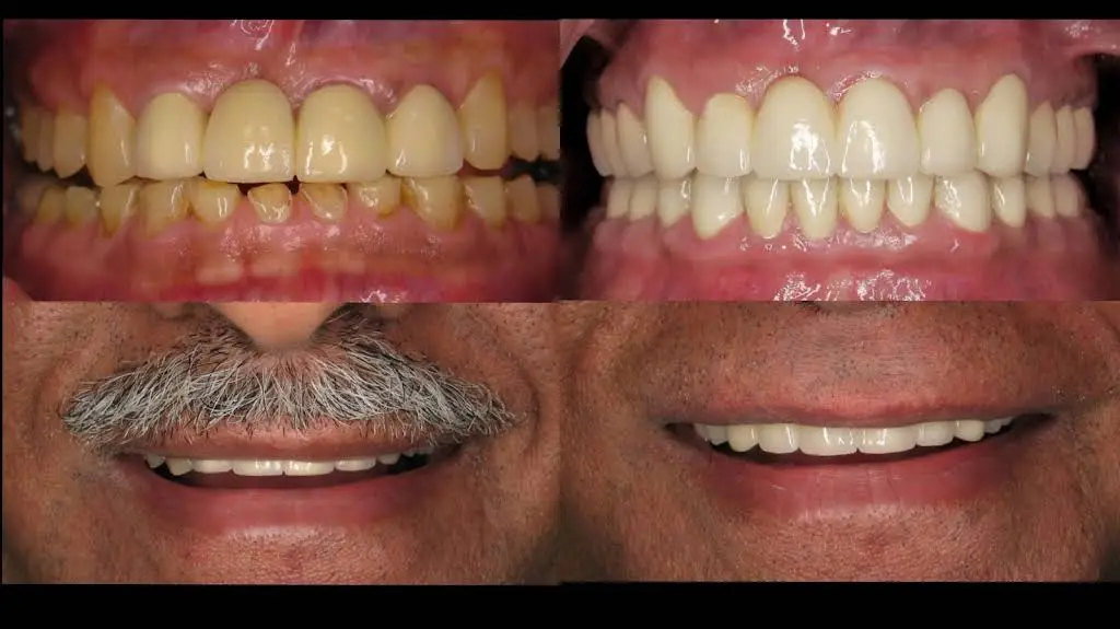 Port Smiles