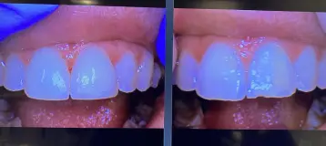 My Port Washington Dentist