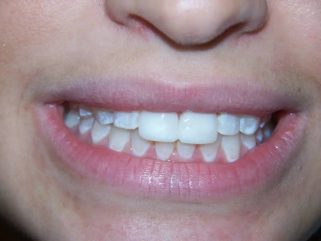 Ferrari & Aldieri Dental Associates