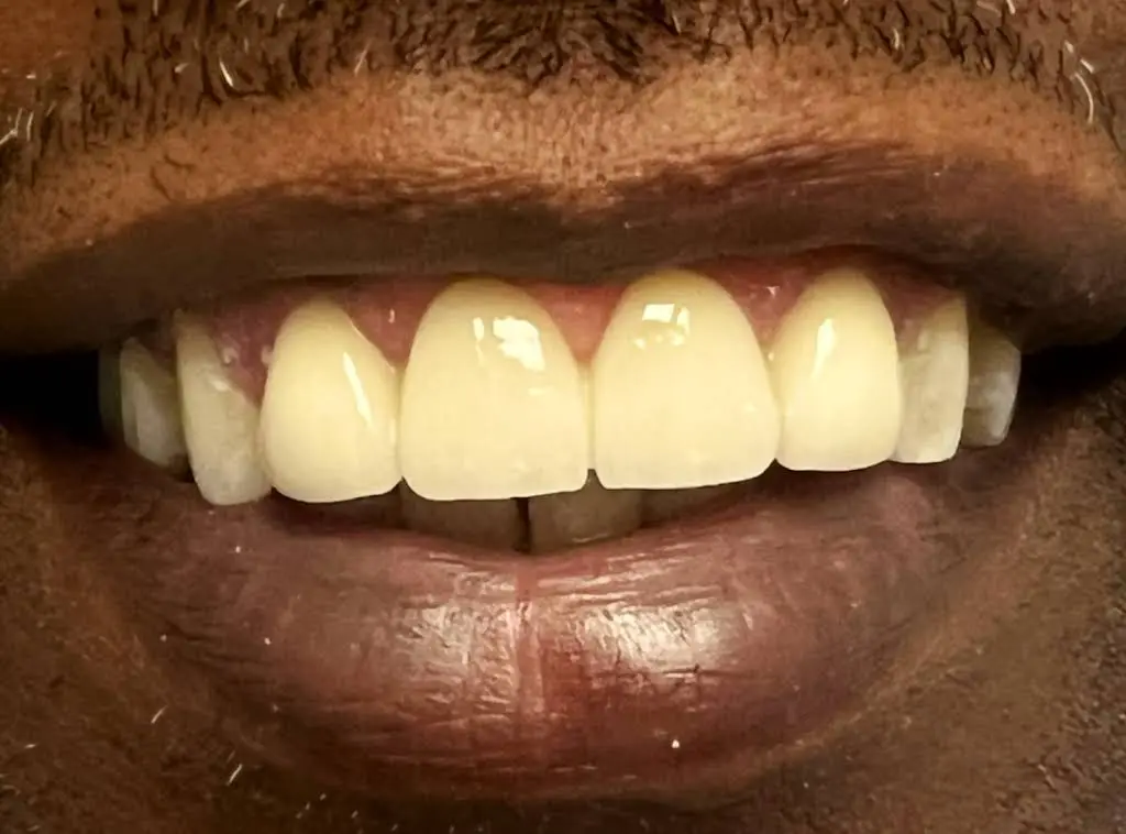 University Dental Associates
