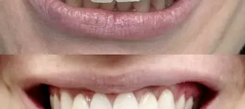 Valhalla Dental PLLC
