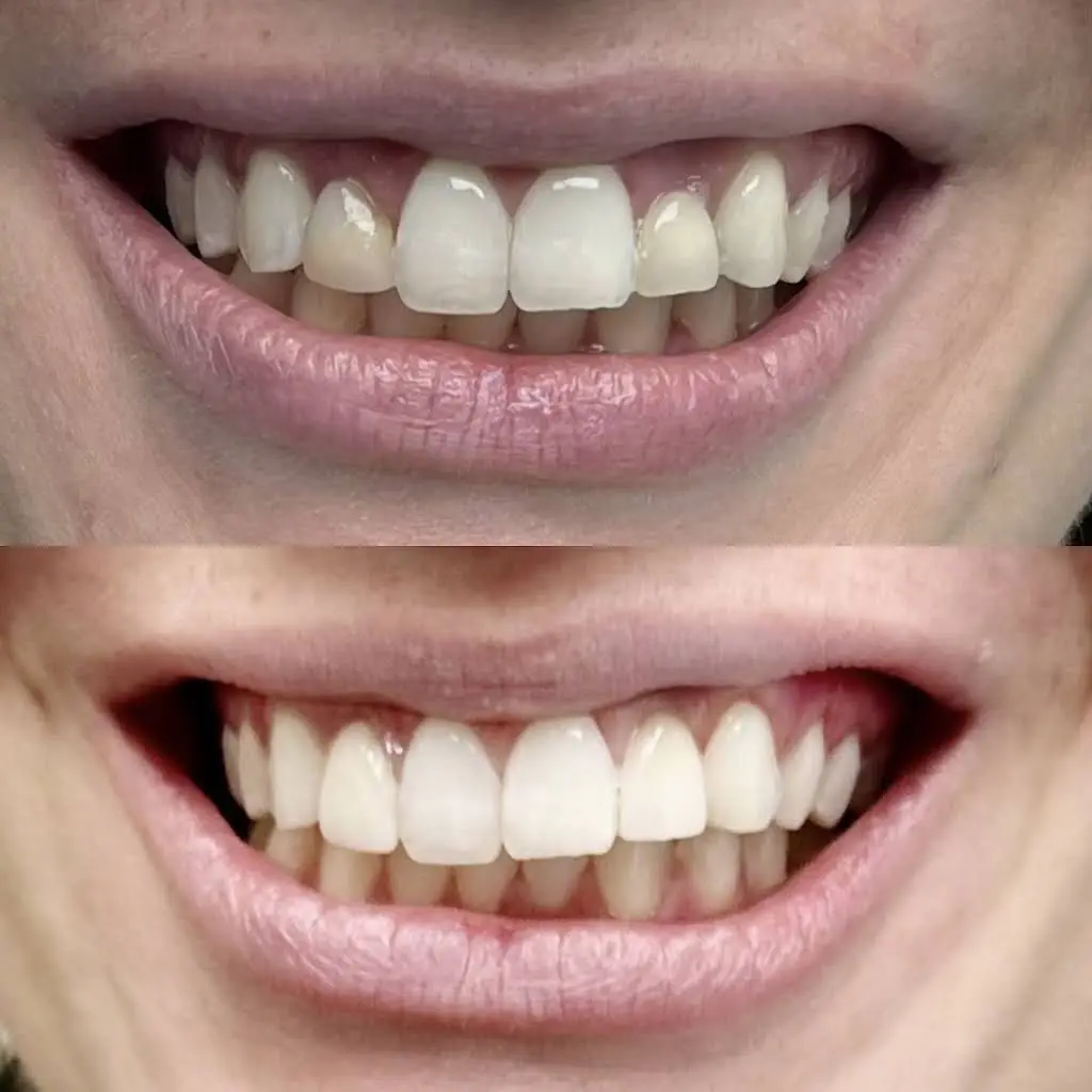 Valhalla Dental PLLC - Professional dental clinic exterior with modern facilities