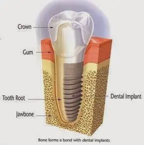Hudson Valley Implant & Periodontics
