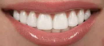 Dental Symmetry