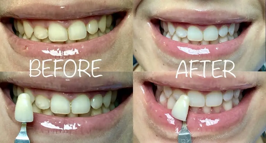 Brace Dental Service