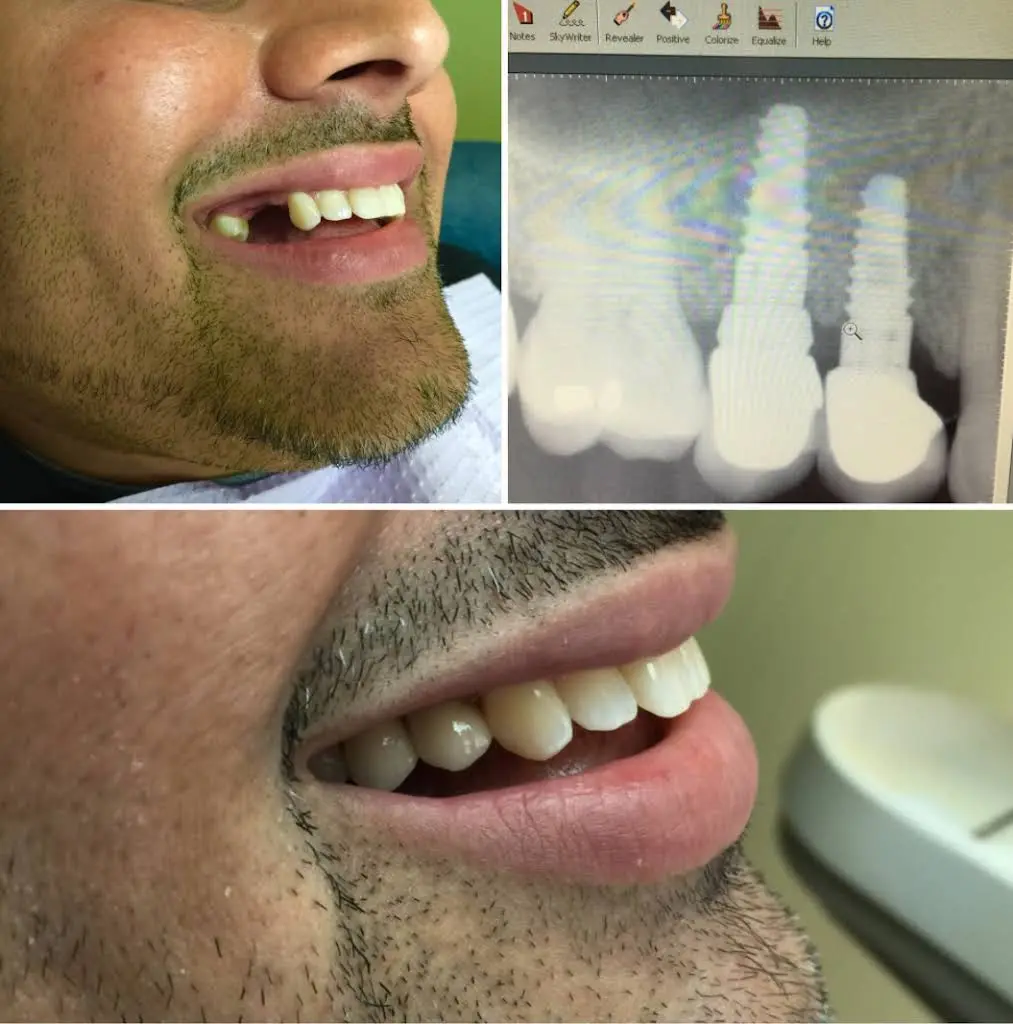 Brace Dental Service