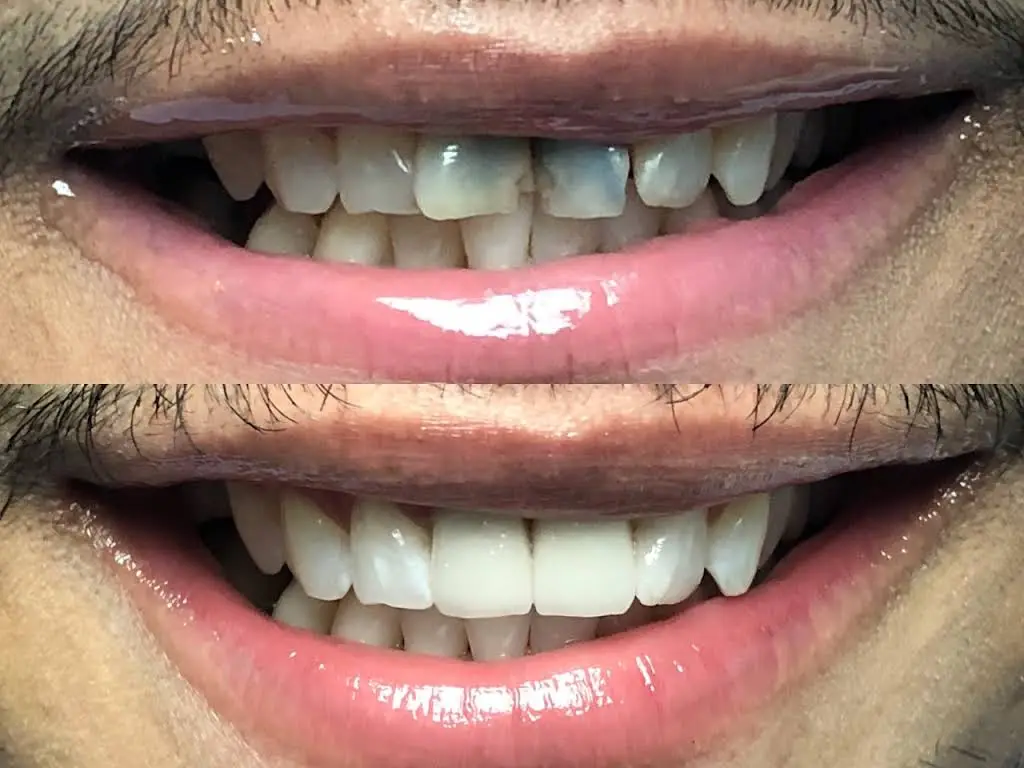 Brace Dental Service