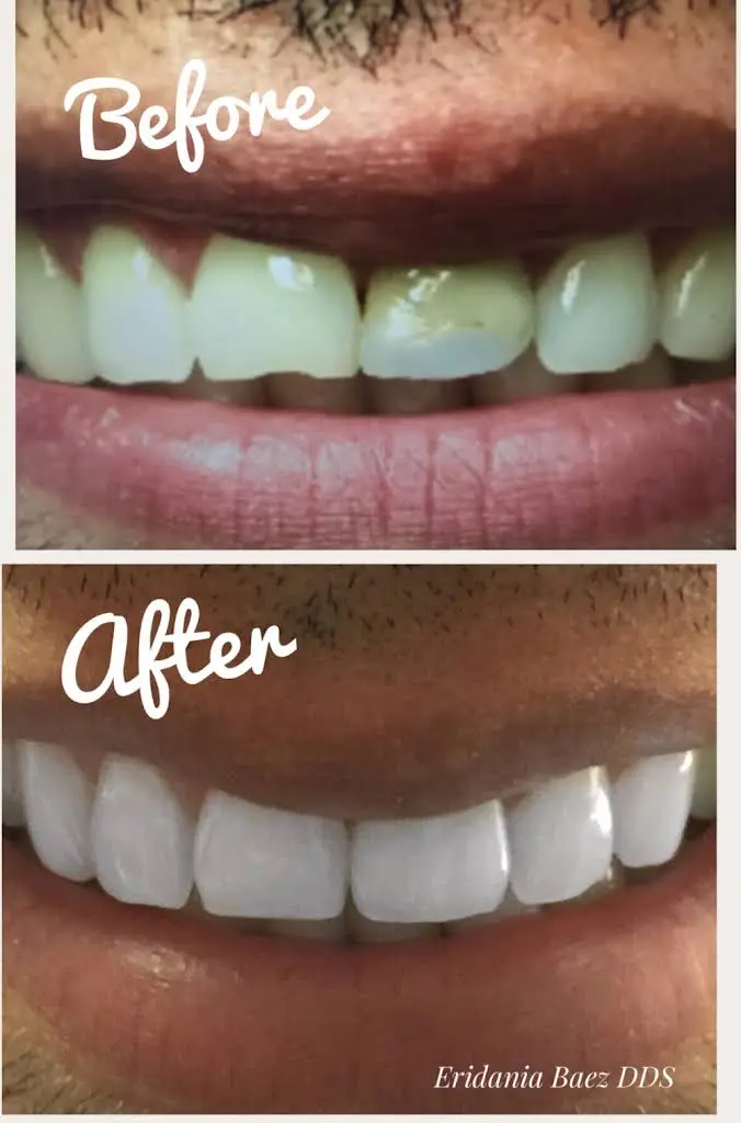 Brace Dental Service