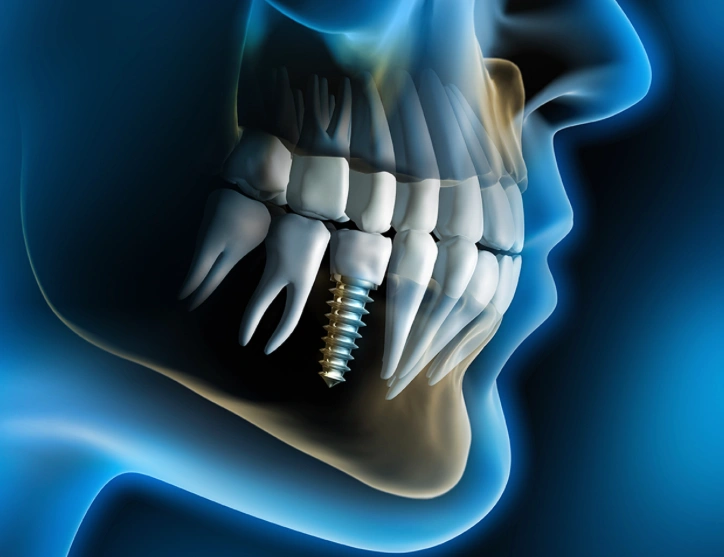 Melillo Dental Associates - Professional dental clinic exterior with modern facilities