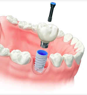 Melillo Dental Associates