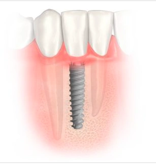 Melillo Dental Associates
