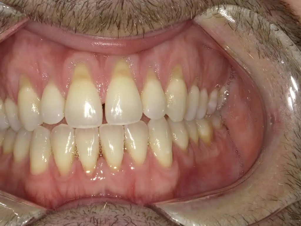 White Plains Dental