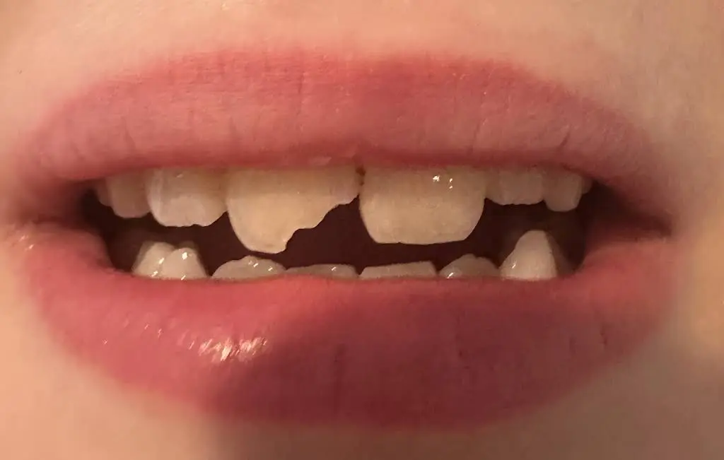 Summerfield Pediatric Dentistry & Oral Surgery - SPD Orthodontics