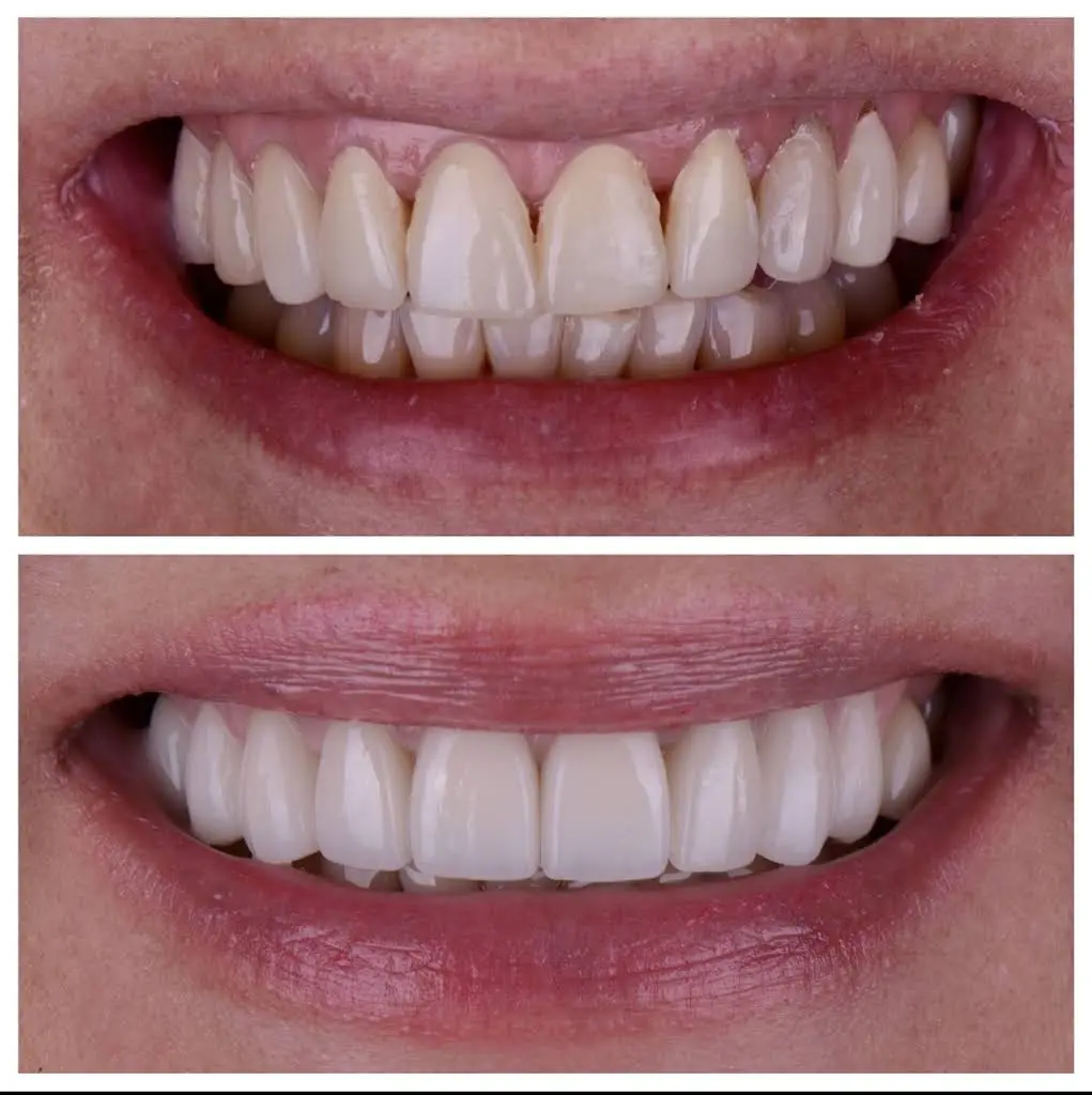 Hudson Dental Co.