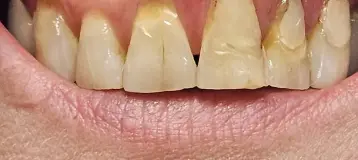Donato A. Valente, DDS, PC