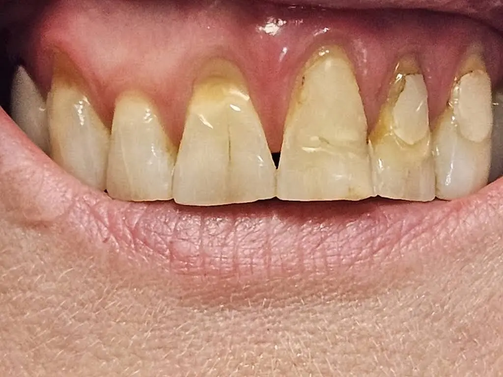 Donato A. Valente, DDS, PC - Professional dental clinic exterior with modern facilities