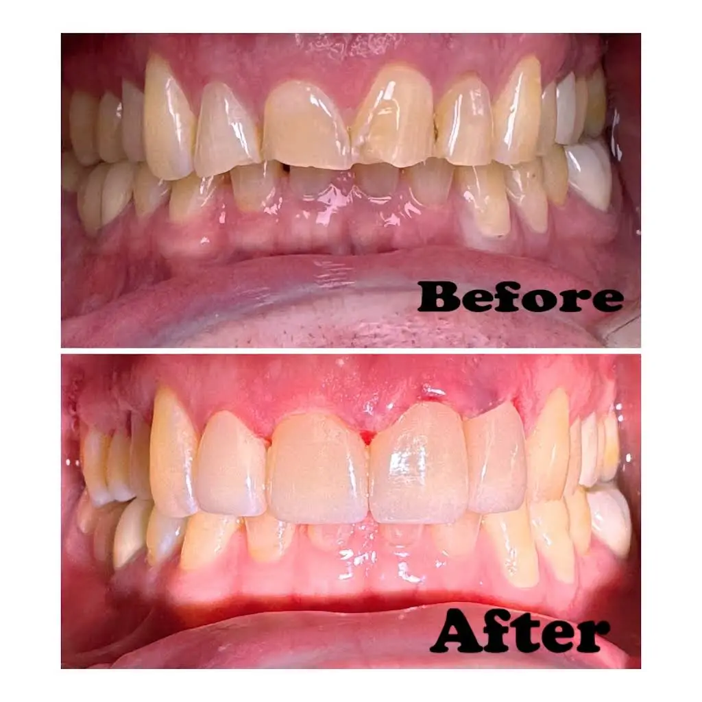 Yoo Smile Dental