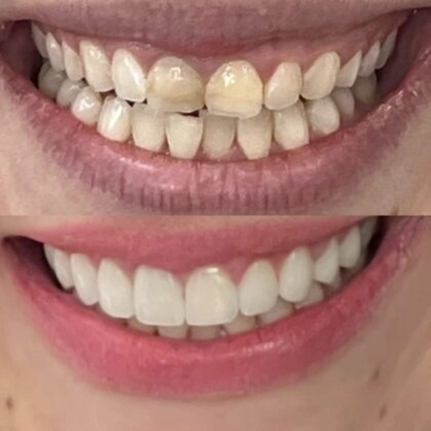 Green Pond Dental Associates